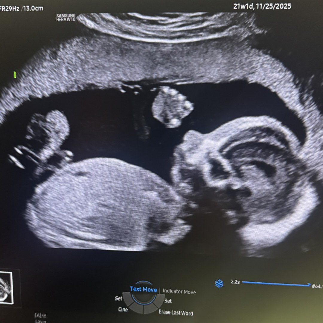 Photo shared by Samantha for their Babylist baby registry.