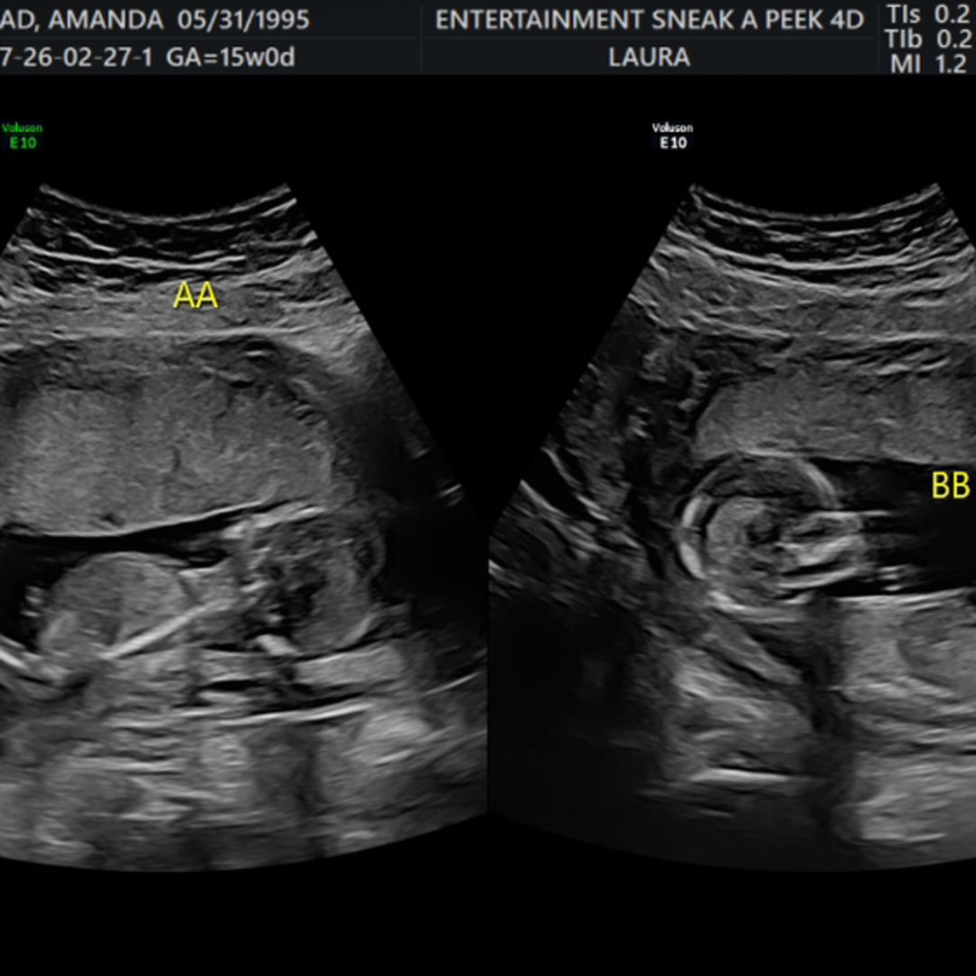 Photo shared by Amanda for their Babylist baby registry.