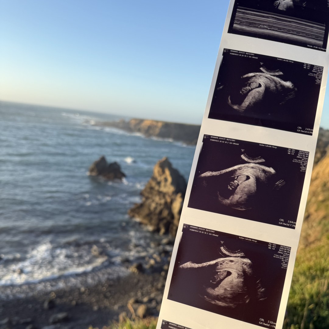 Photo shared by Ashley for their Babylist baby registry.