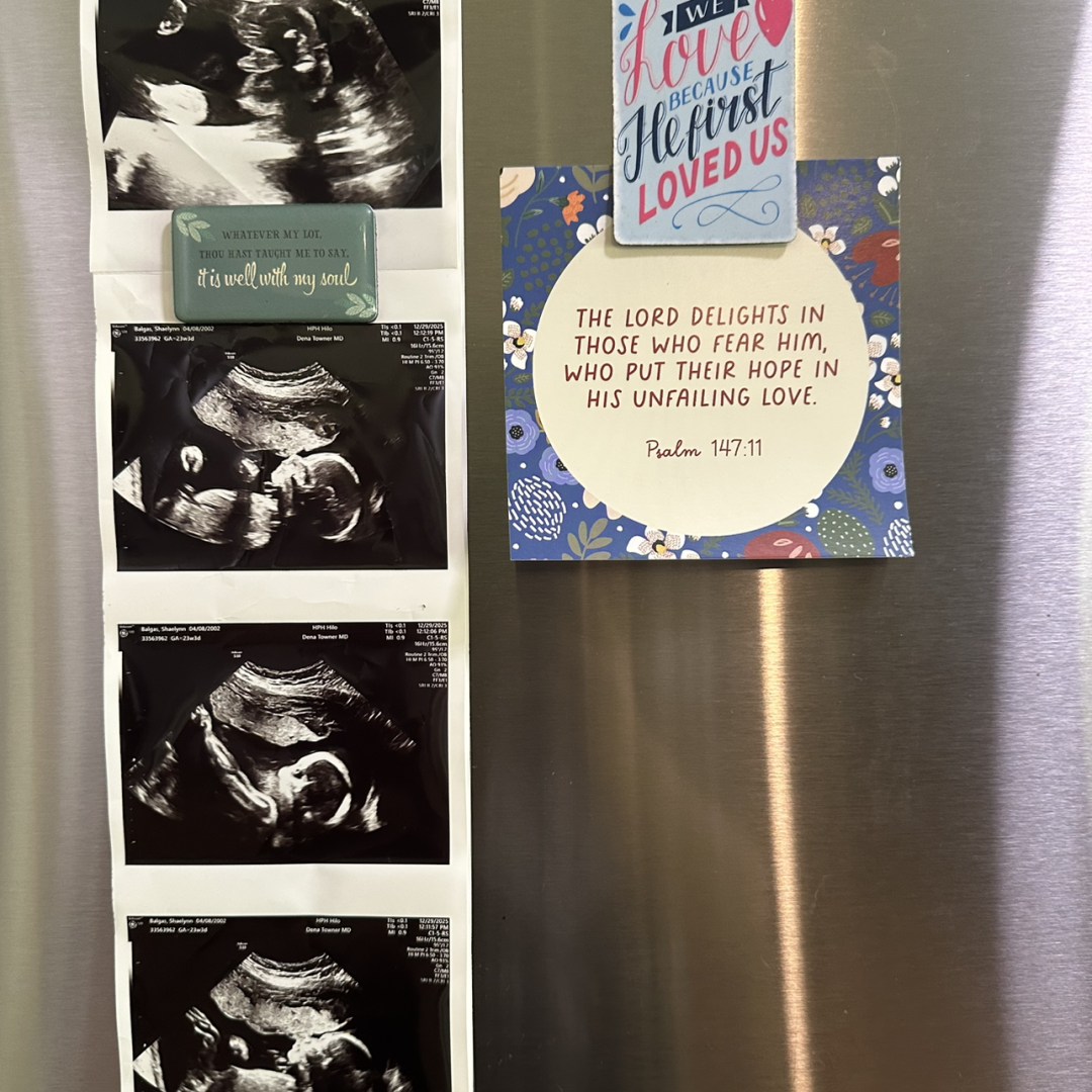 Photo shared by Shaelynn for their Babylist baby registry.