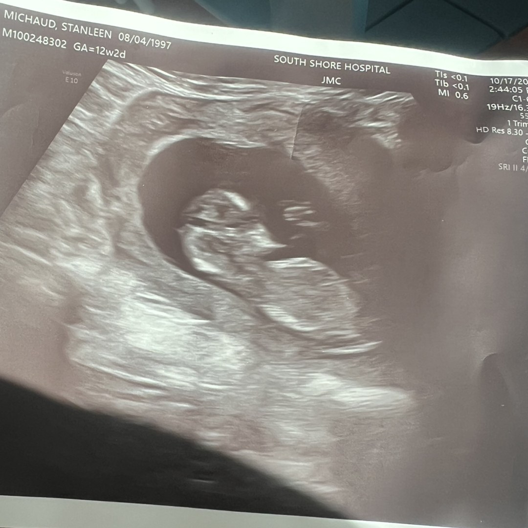 Photo shared by Stanleen for their Babylist baby registry.