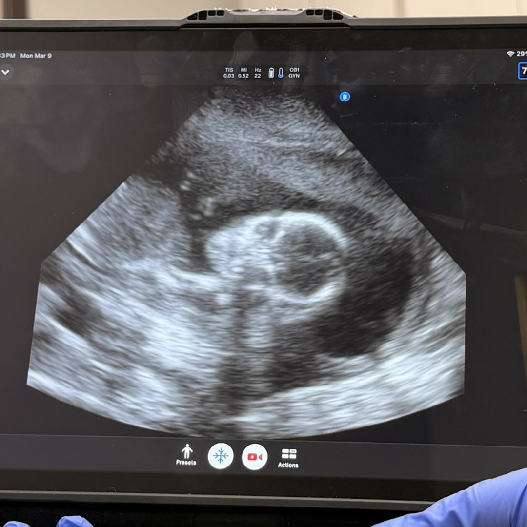 Photo shared by Miranda and Kade for their Babylist baby registry.