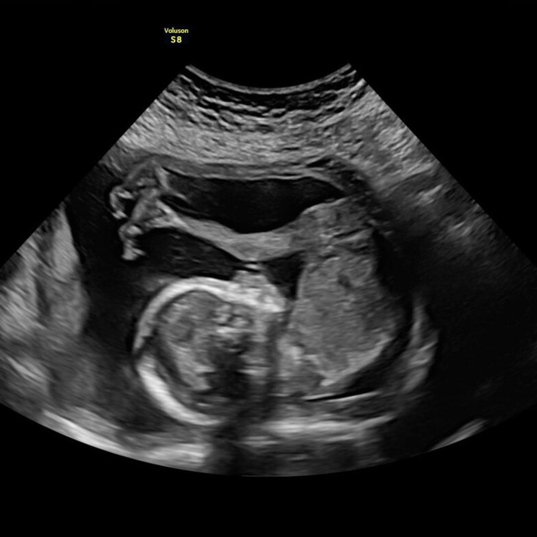 Photo shared by Makenzie for their Babylist baby registry.