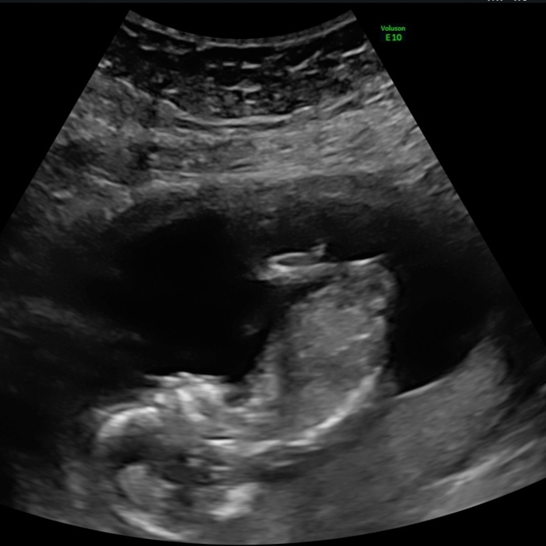 Photo shared by McKaida for their Babylist baby registry.