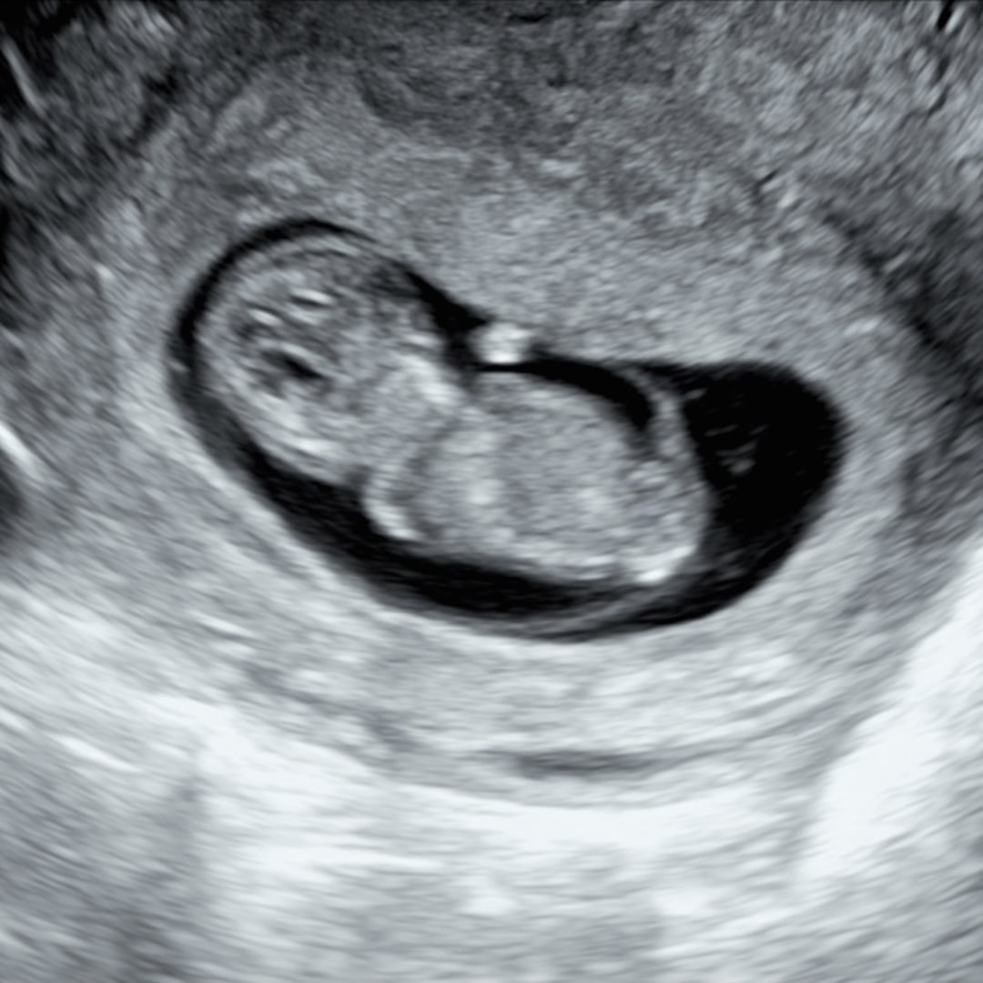 Photo shared by Angelica for their Babylist baby registry.