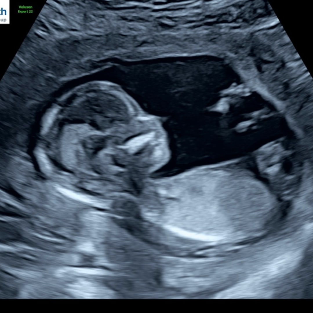 Photo shared by Amber for their Babylist baby registry.