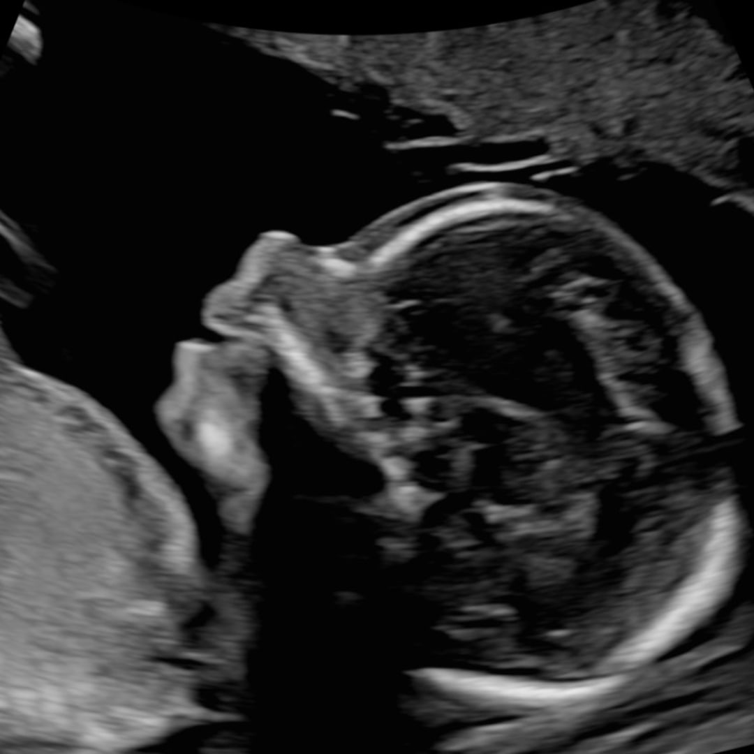 Photo shared by Ellen for their Babylist baby registry.