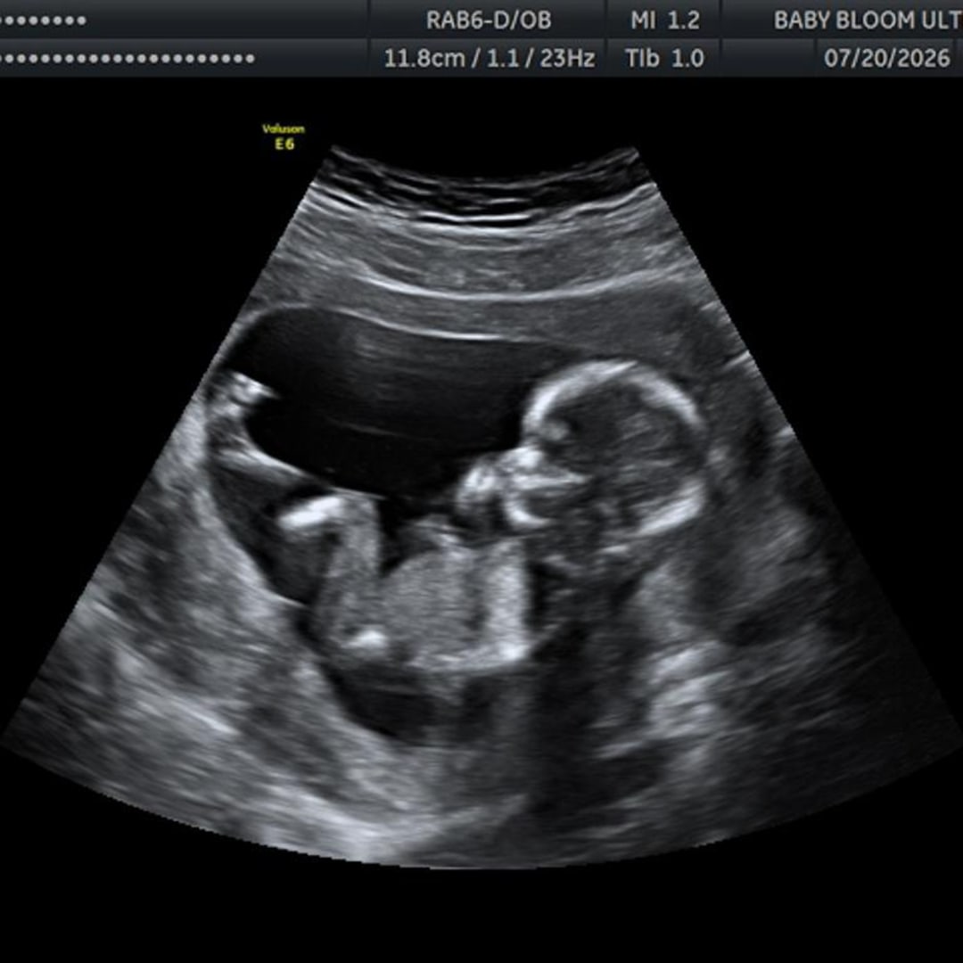 Photo shared by Kaira for their Babylist baby registry.
