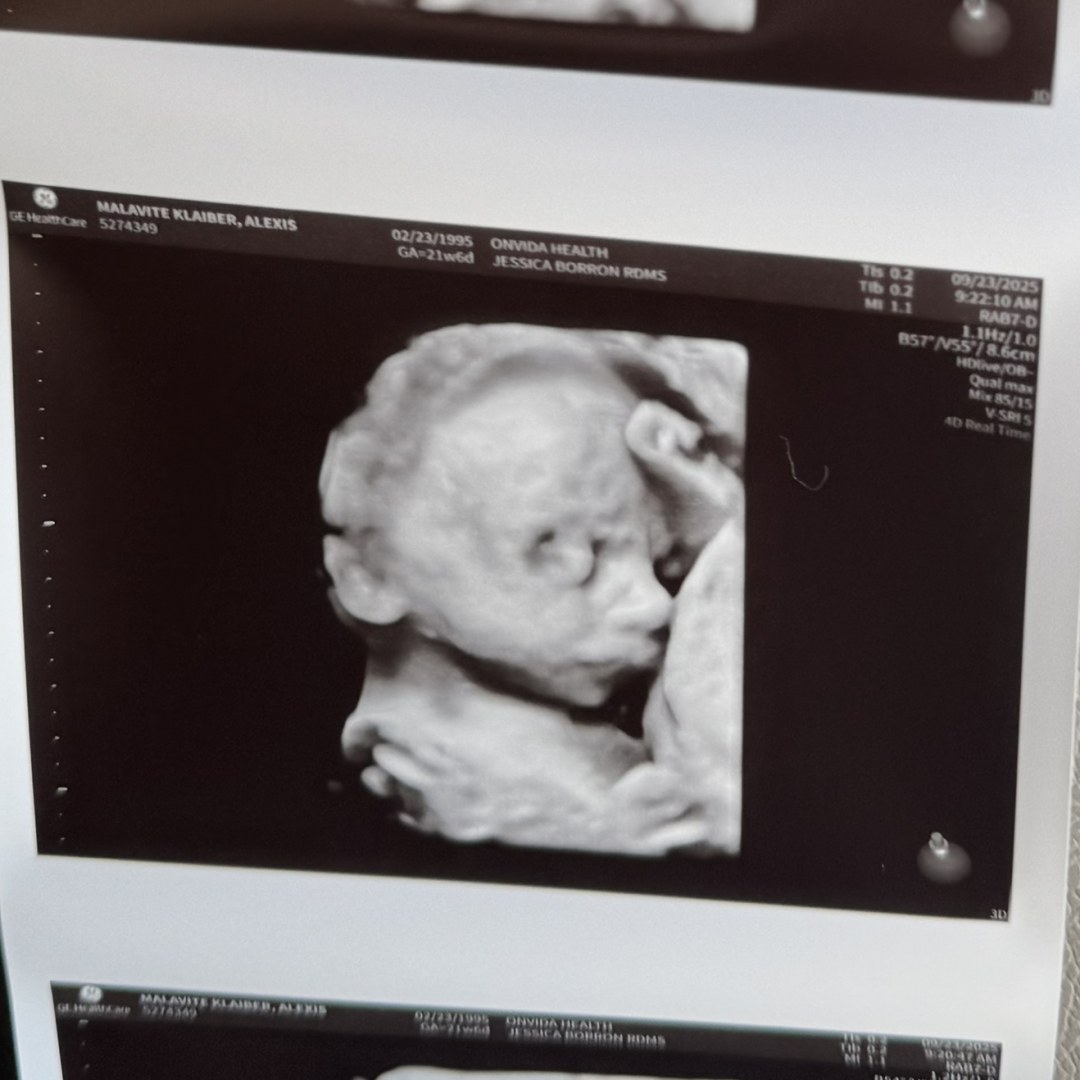 Photo shared by Alexis for their Babylist baby registry.