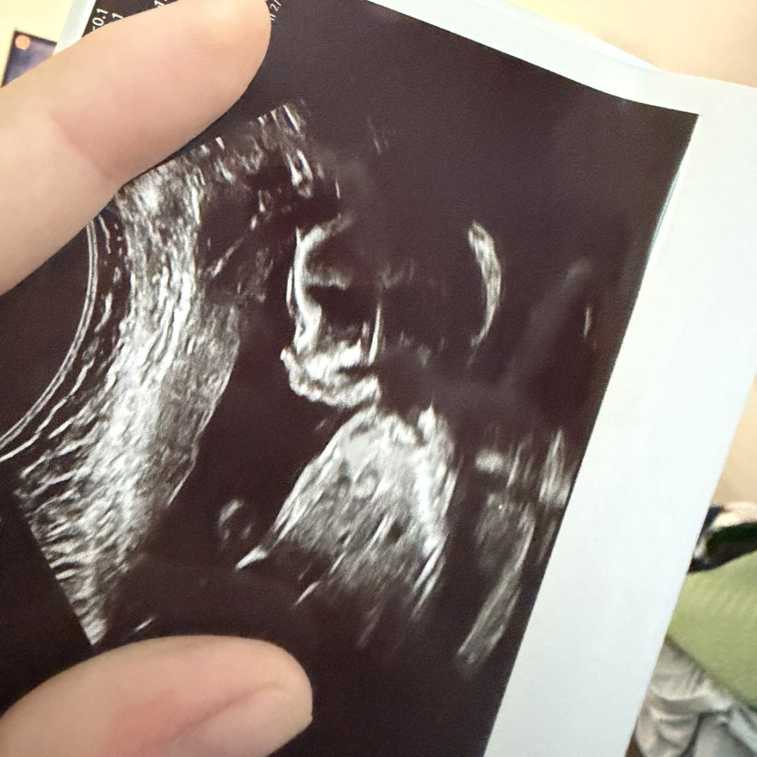 Photo shared by Margaret for their Babylist baby registry.