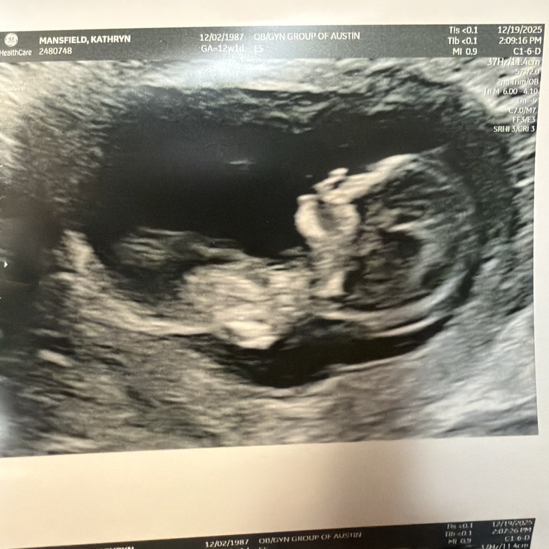 Photo shared by Kathryn for their Babylist baby registry.