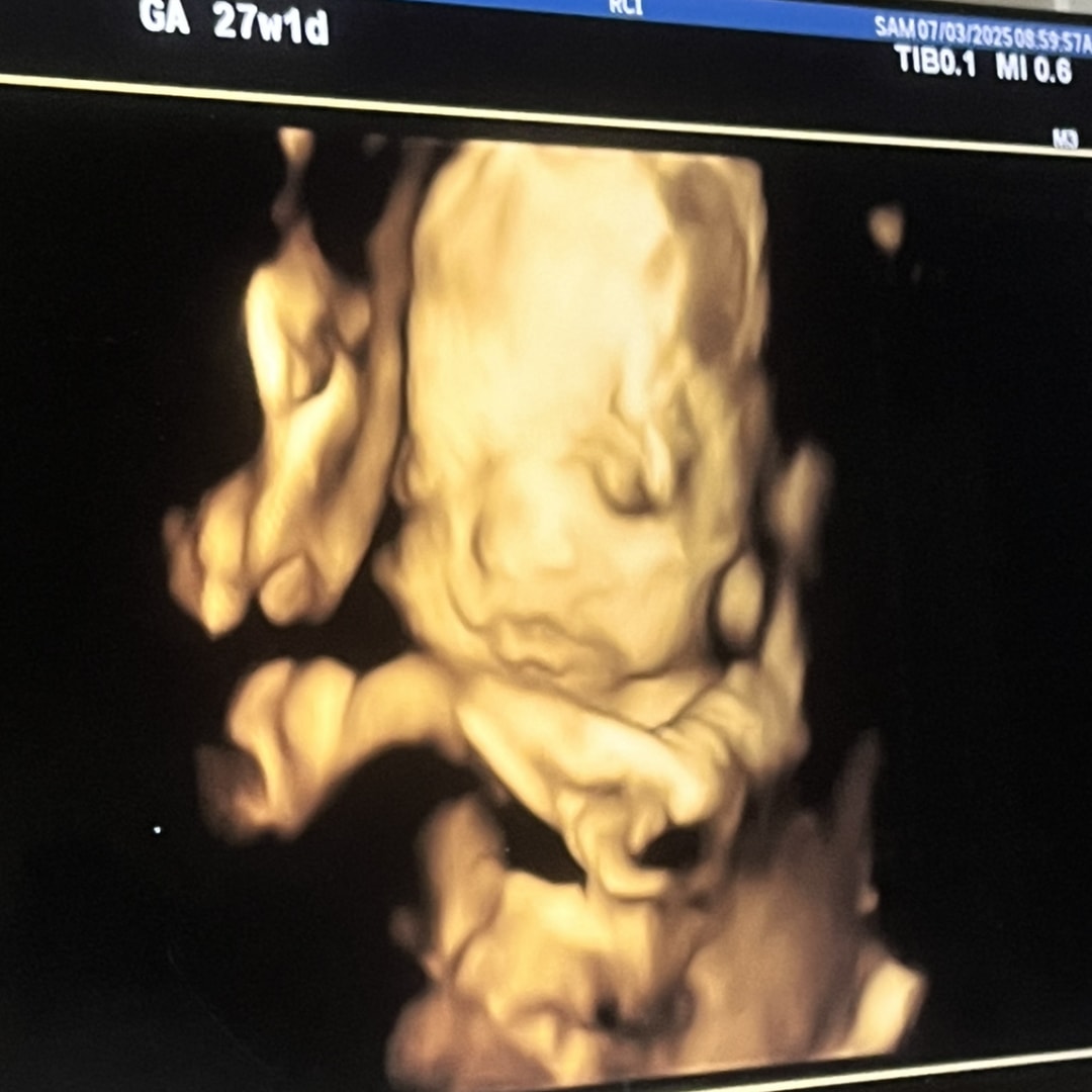 Photo shared by Kiley for their Babylist baby registry.
