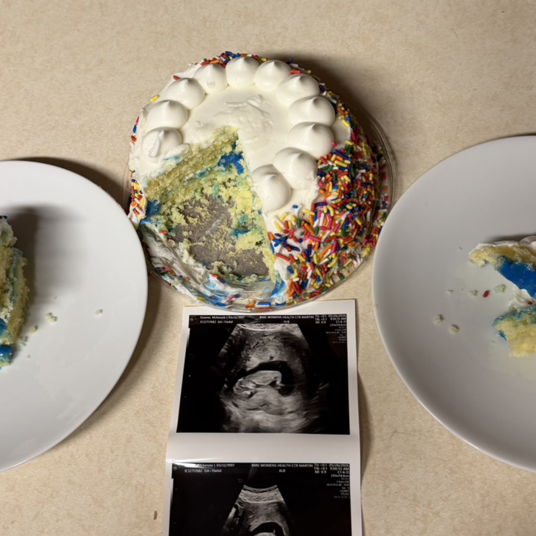 Photo shared by McKenzie for their Babylist baby registry.