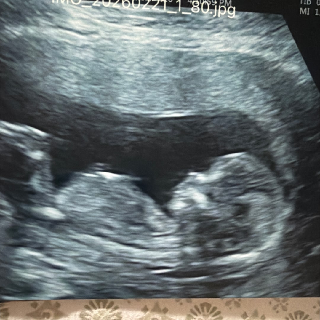 Photo shared by Tiffany for their Babylist baby registry.
