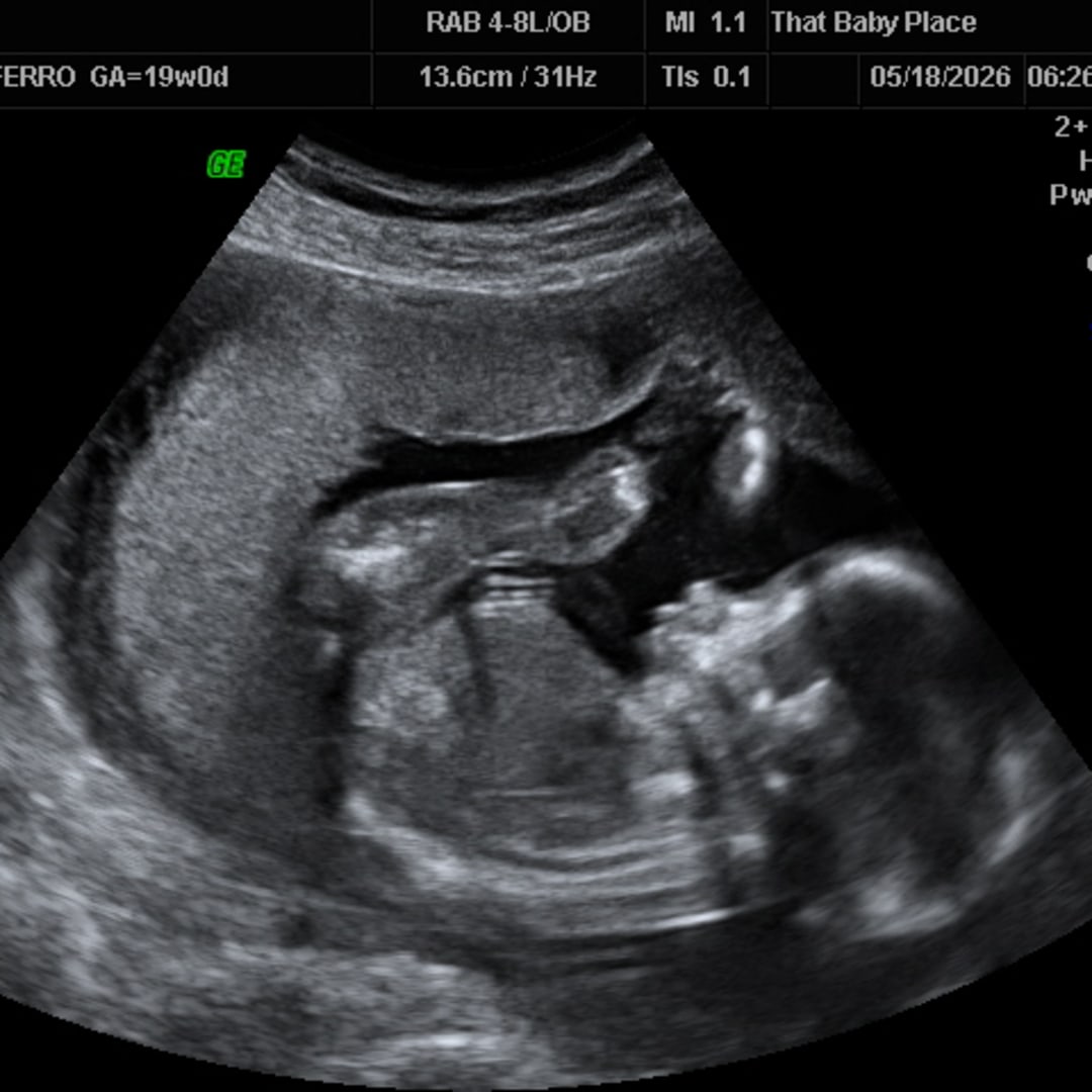 Photo shared by Morgan for their Babylist baby registry.