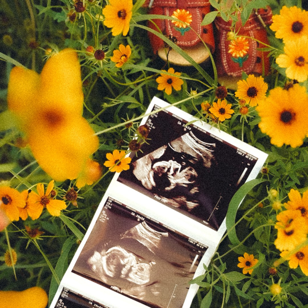 Photo shared by Makayla for their Babylist baby registry.