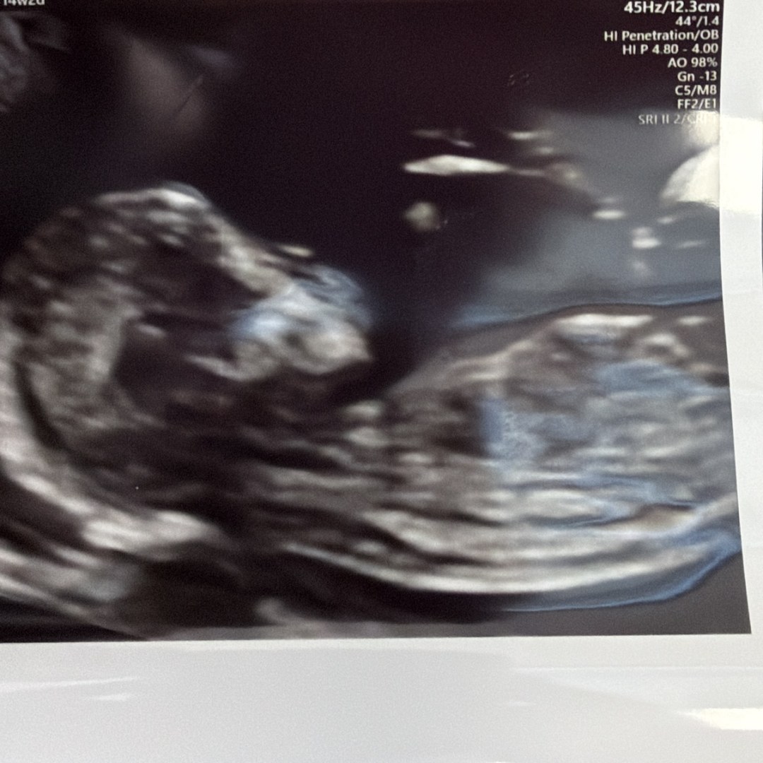 Photo shared by Laurel for their Babylist baby registry.
