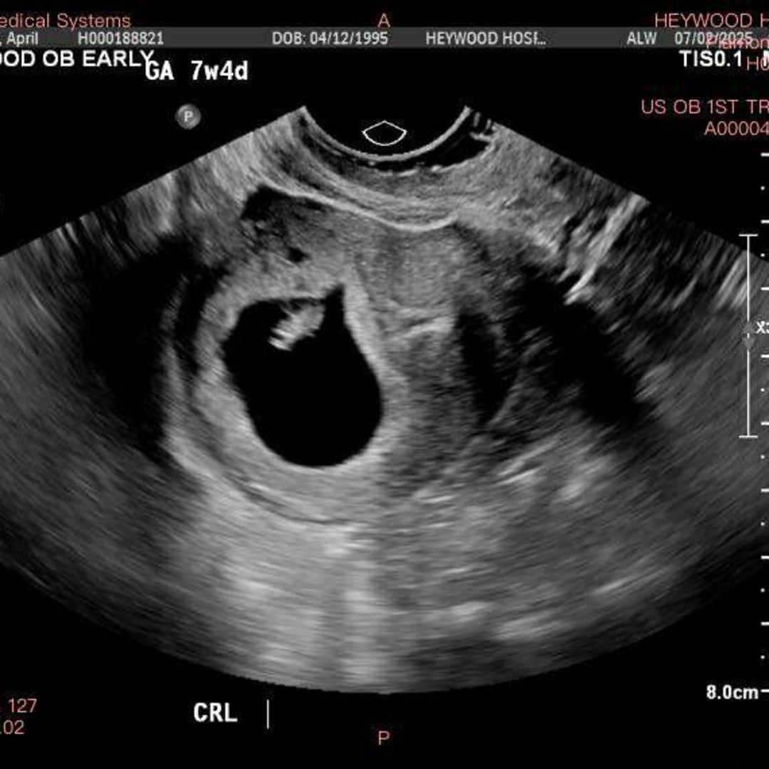 Photo shared by April for their Babylist baby registry.