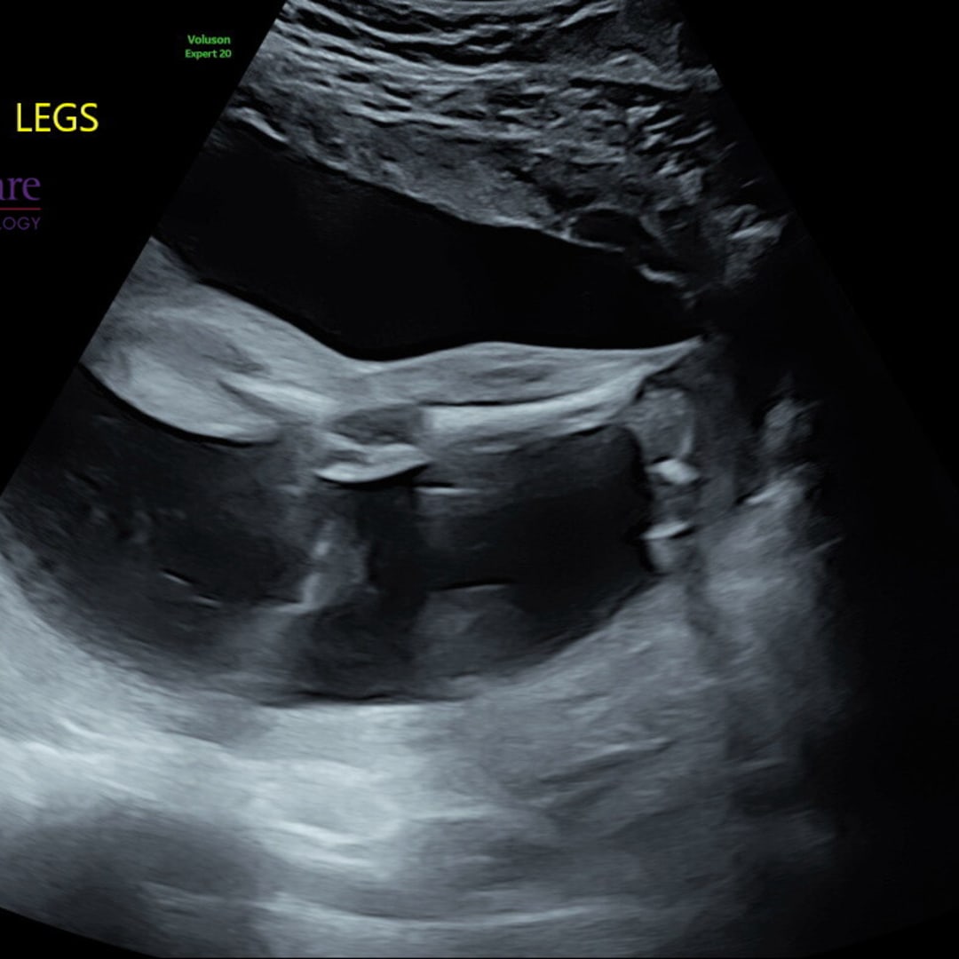 Photo shared by Chelsea for their Babylist baby registry.