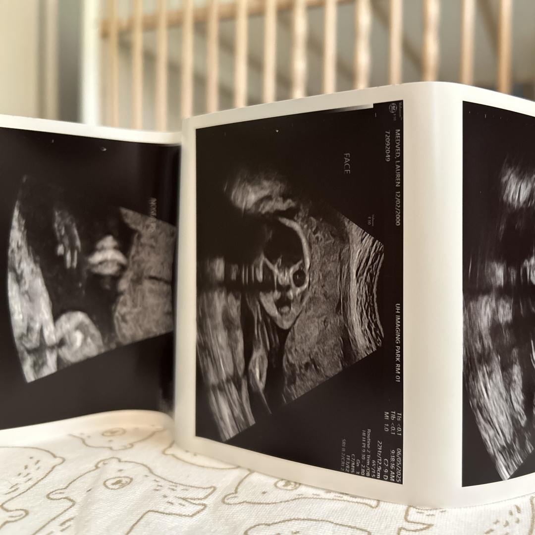 Photo shared by Lauren for their Babylist baby registry.