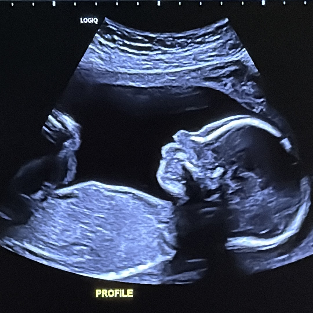 Photo shared by Ally for their Babylist baby registry.