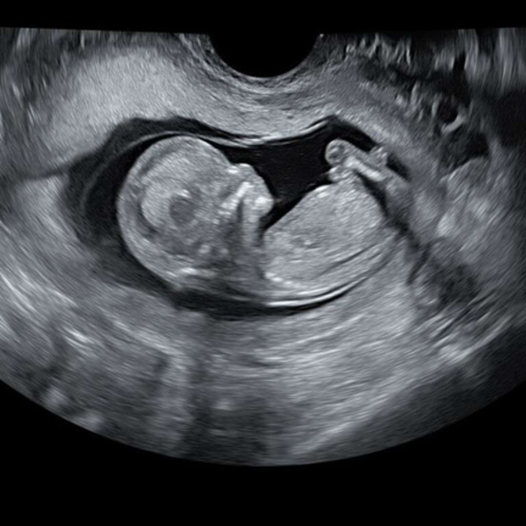 Photo shared by Baylie for their Babylist baby registry.
