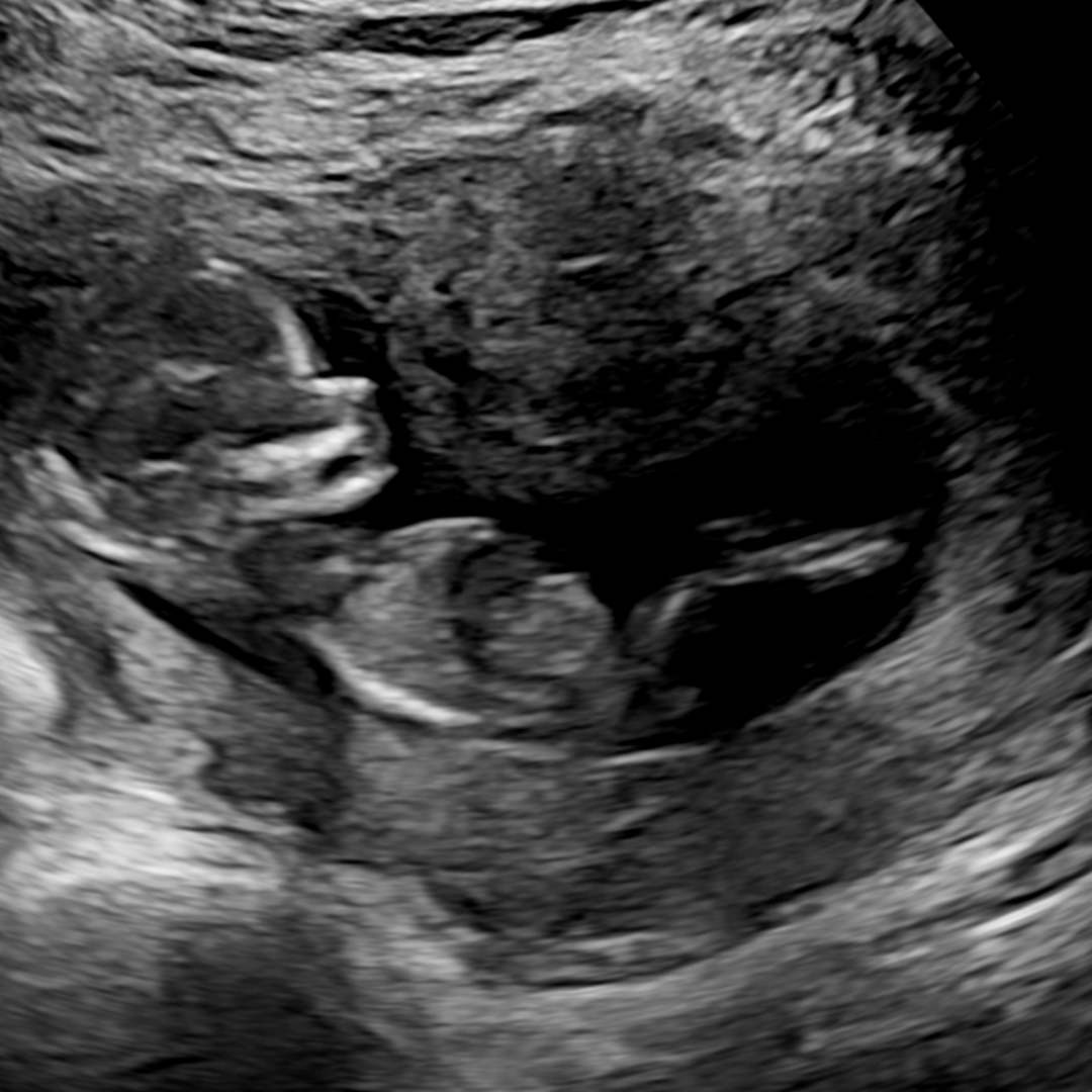 Photo shared by Eraclio for their Babylist baby registry.