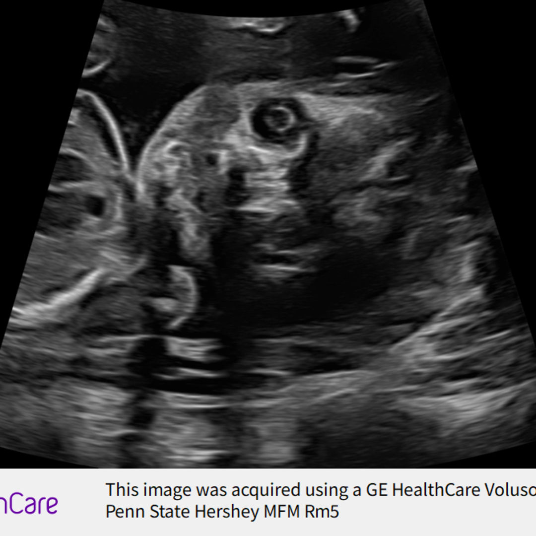 Photo shared by Karrah for their Babylist baby registry.