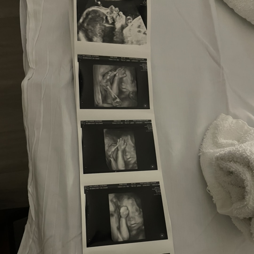 Photo shared by Isabella for their Babylist baby registry.