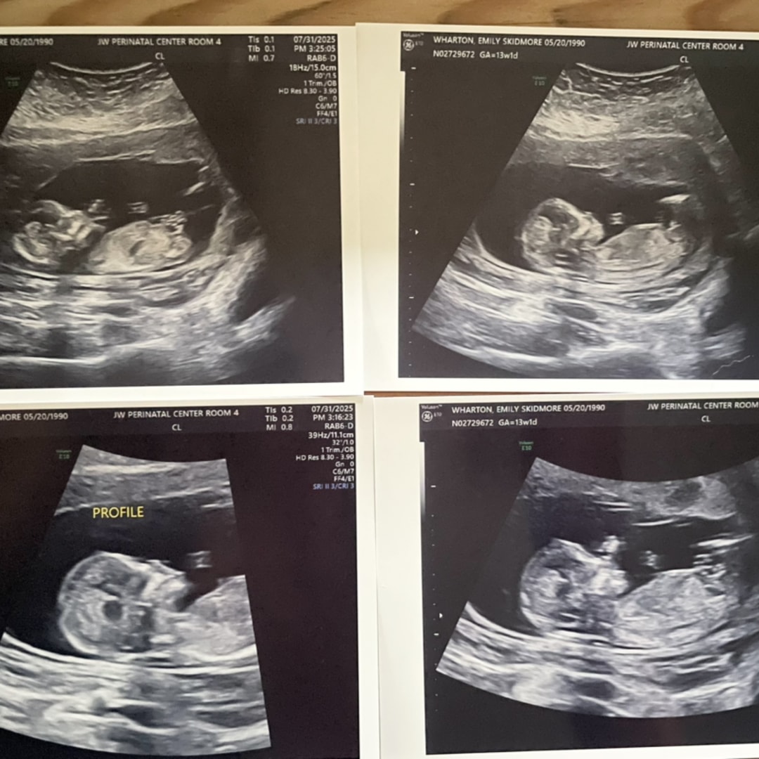 Photo shared by Emily for their Babylist baby registry.