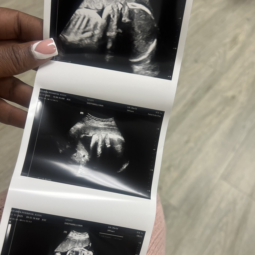 Photo shared by Corin for their Babylist baby registry.