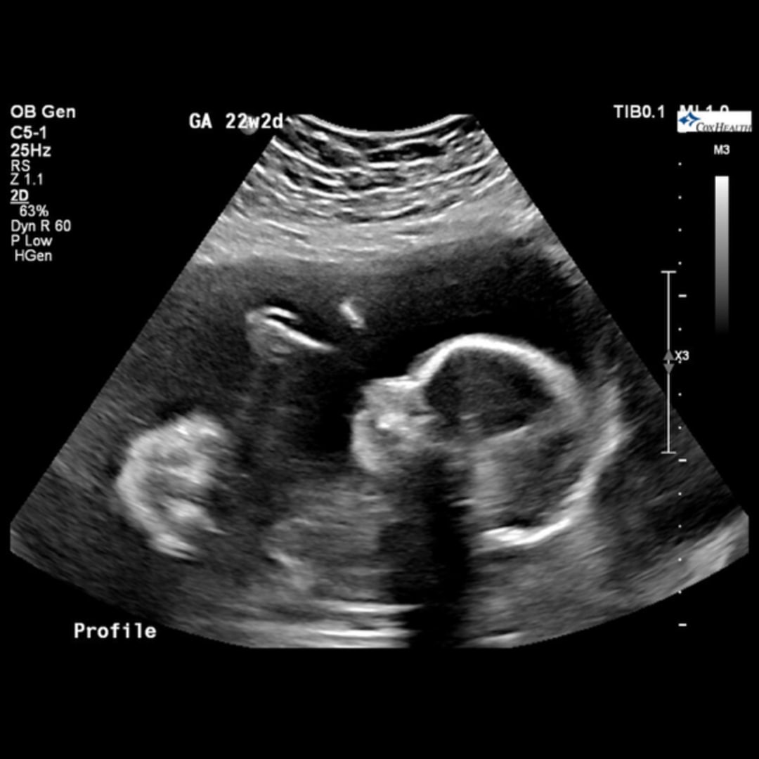 Photo shared by Emily for their Babylist baby registry.