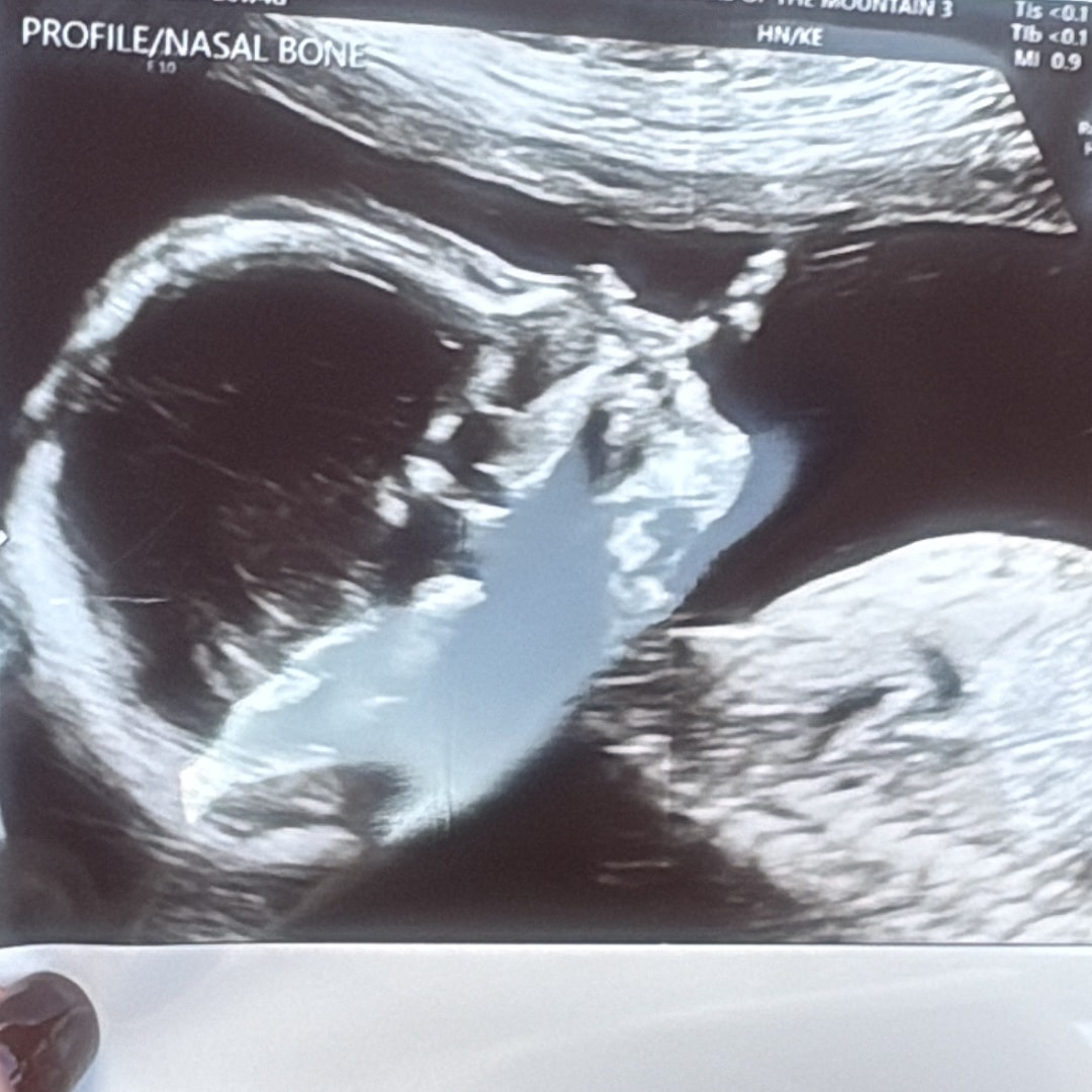 Photo shared by Valentina for their Babylist baby registry.