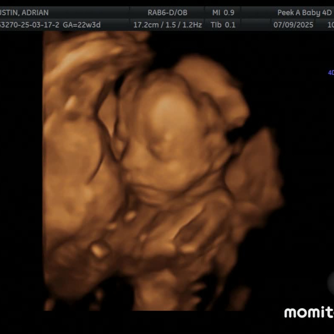 Photo shared by Adrian for their Babylist baby registry.