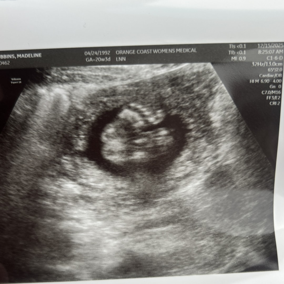 Photo shared by Madeline for their Babylist baby registry.