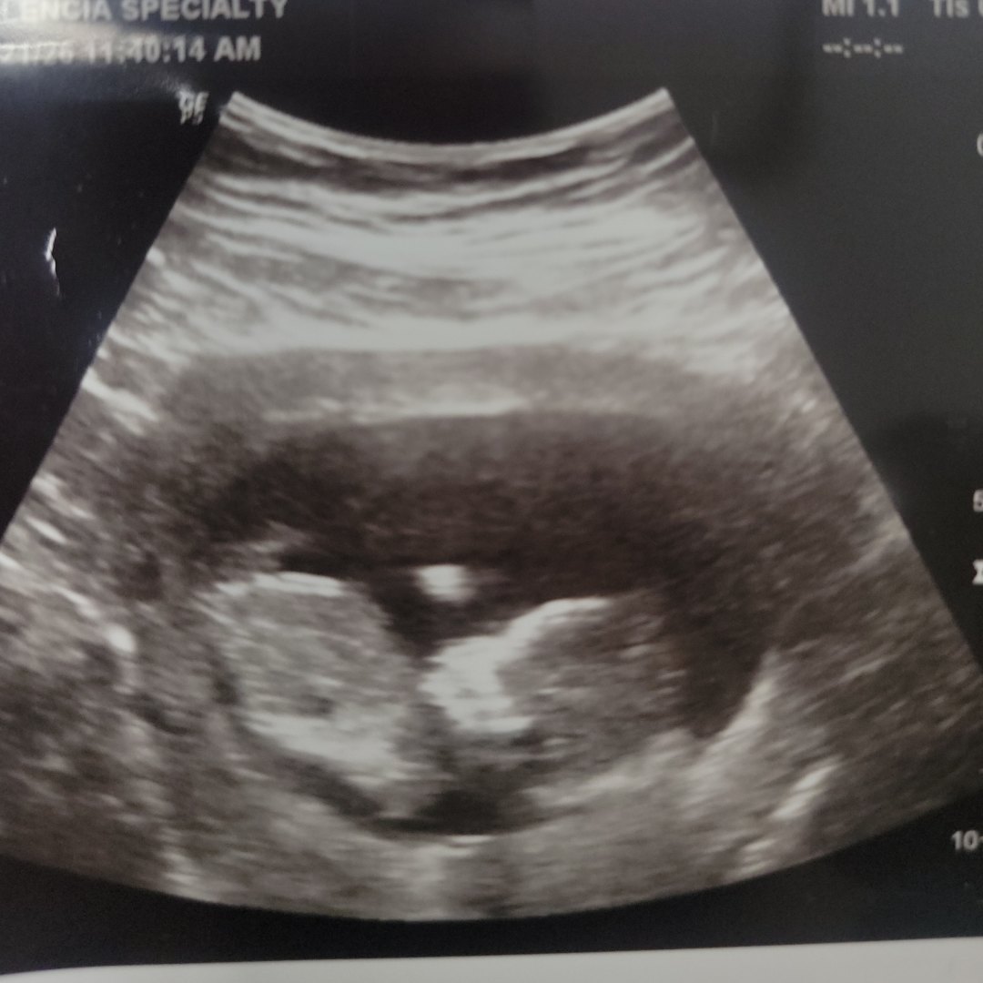 Photo shared by Jessica for their Babylist baby registry.