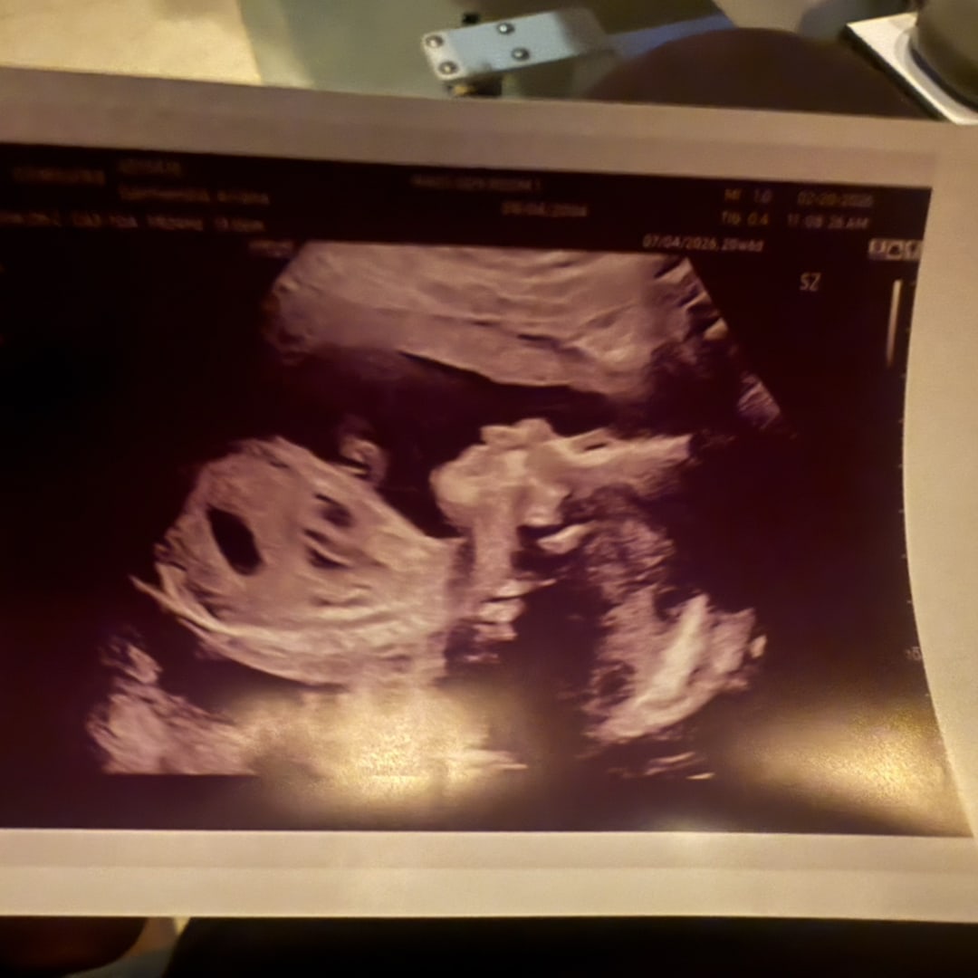 Photo shared by Ariana for their Babylist baby registry.