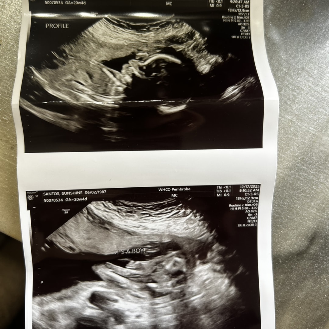 Photo shared by Sunshine for their Babylist baby registry.