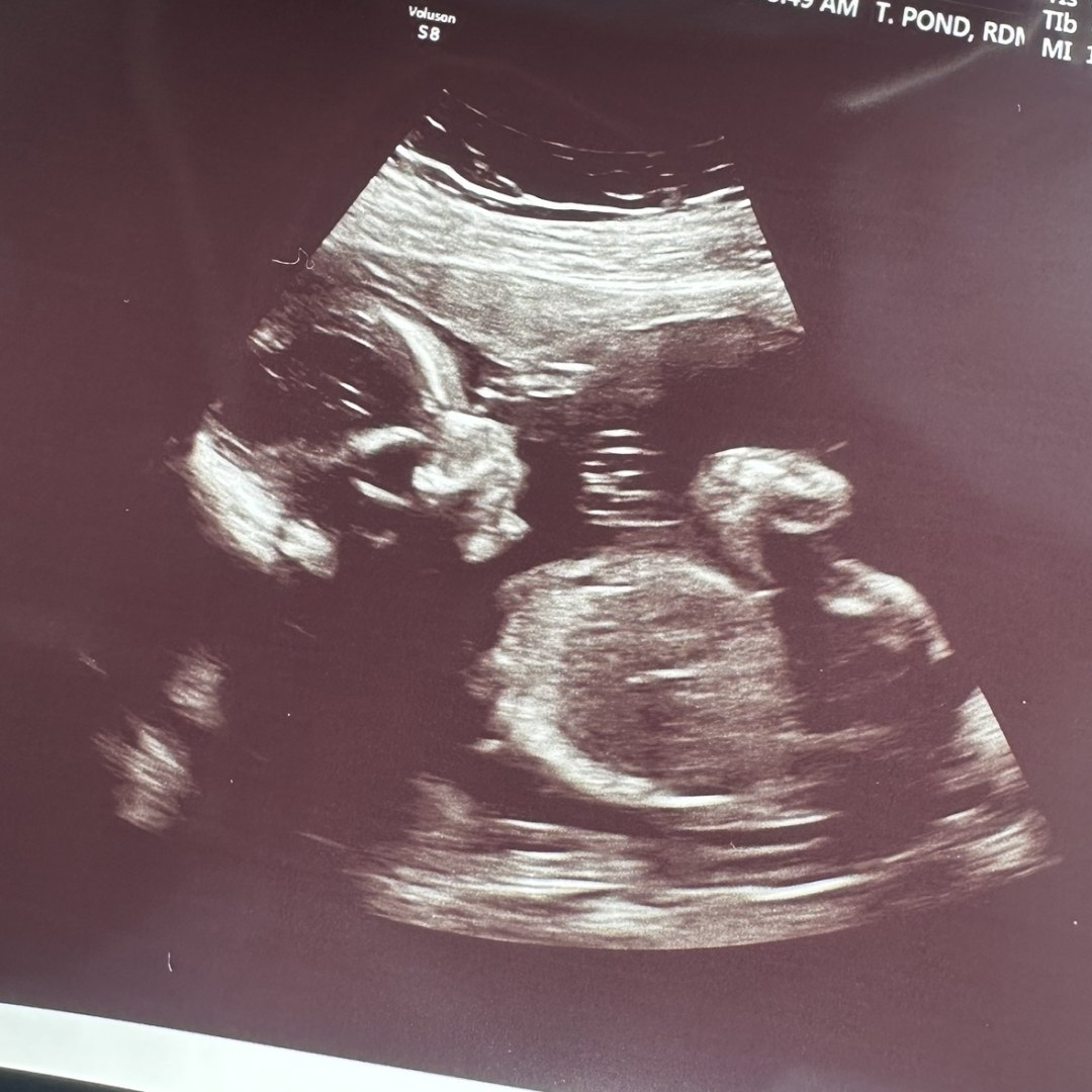 Photo shared by Hannah for their Babylist baby registry.