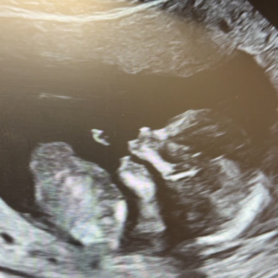 Photo shared by Hannah for their Babylist baby registry.