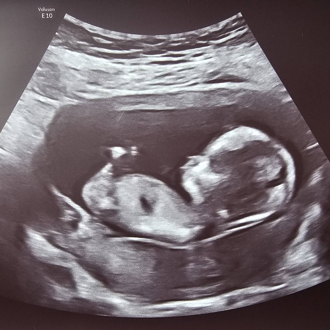 Photo shared by Deanna for their Babylist baby registry.