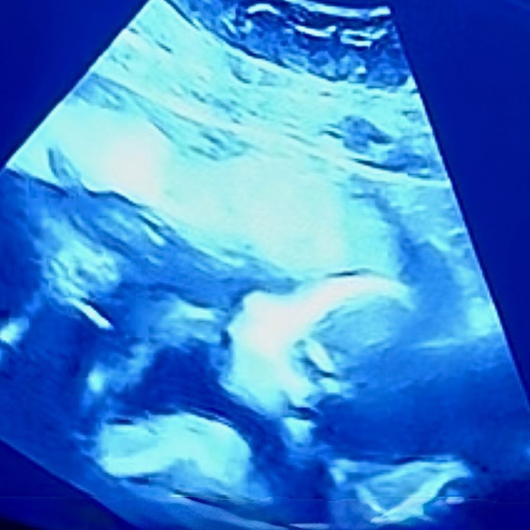 Photo shared by Hannah for their Babylist baby registry.