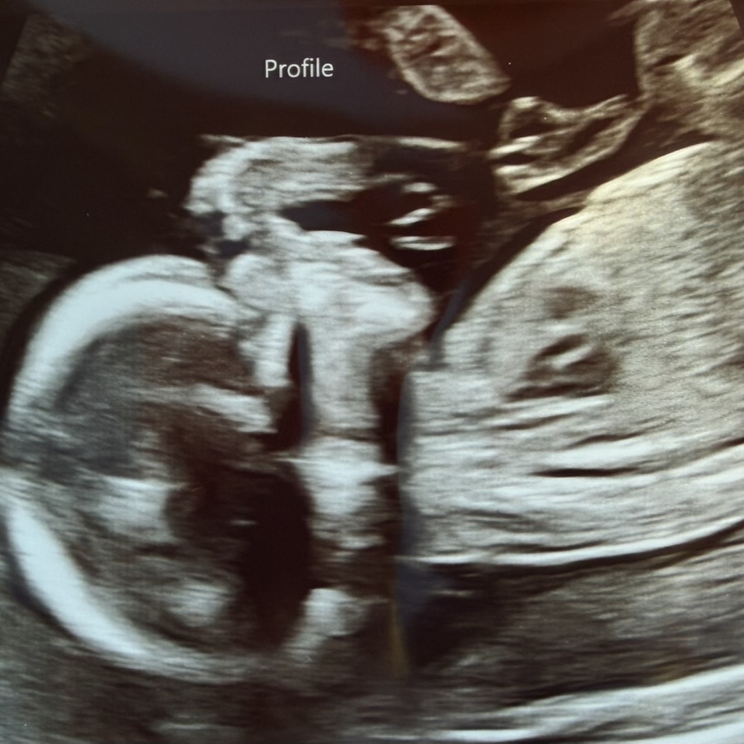 Photo shared by Amanda for their Babylist baby registry.