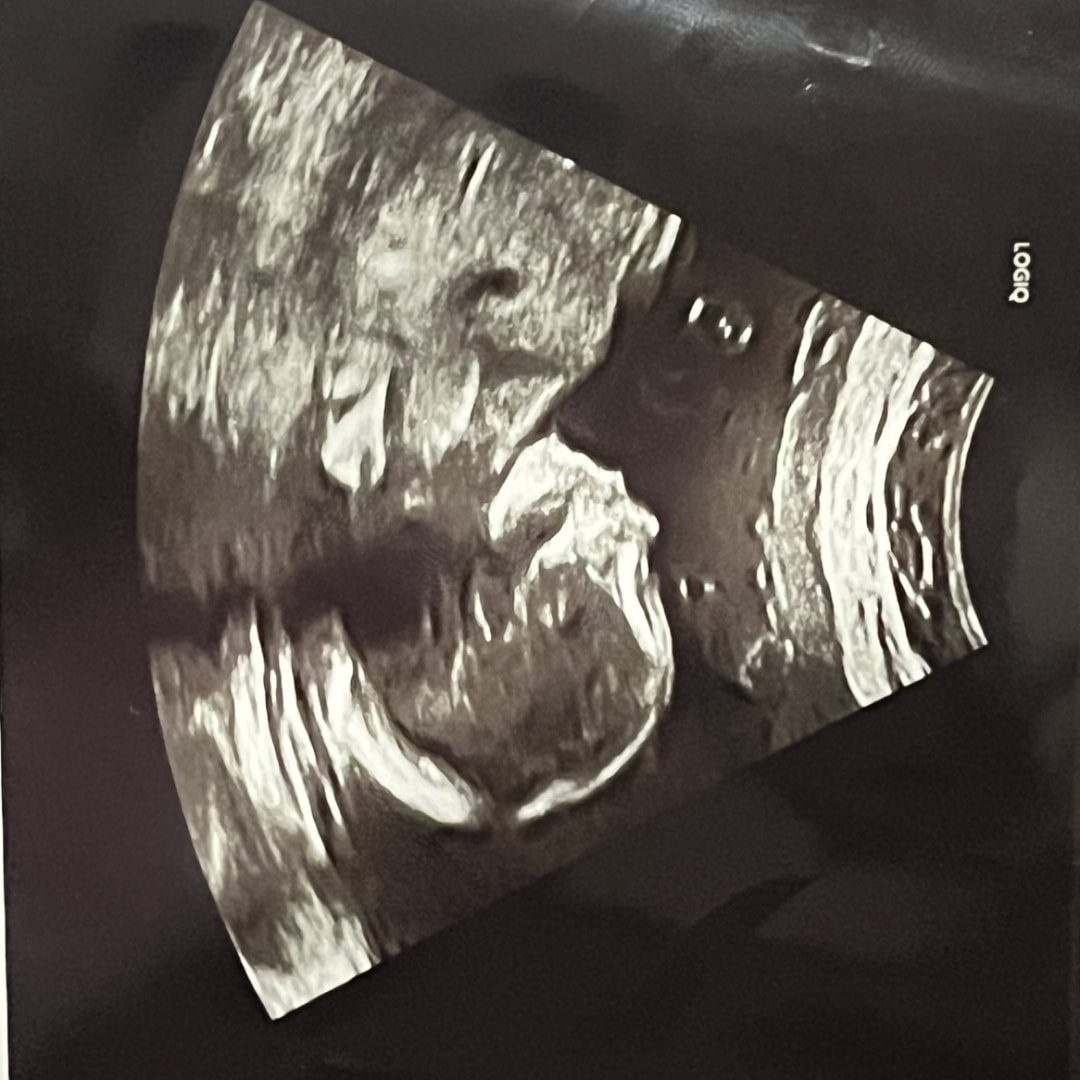 Photo shared by Angela for their Babylist baby registry.