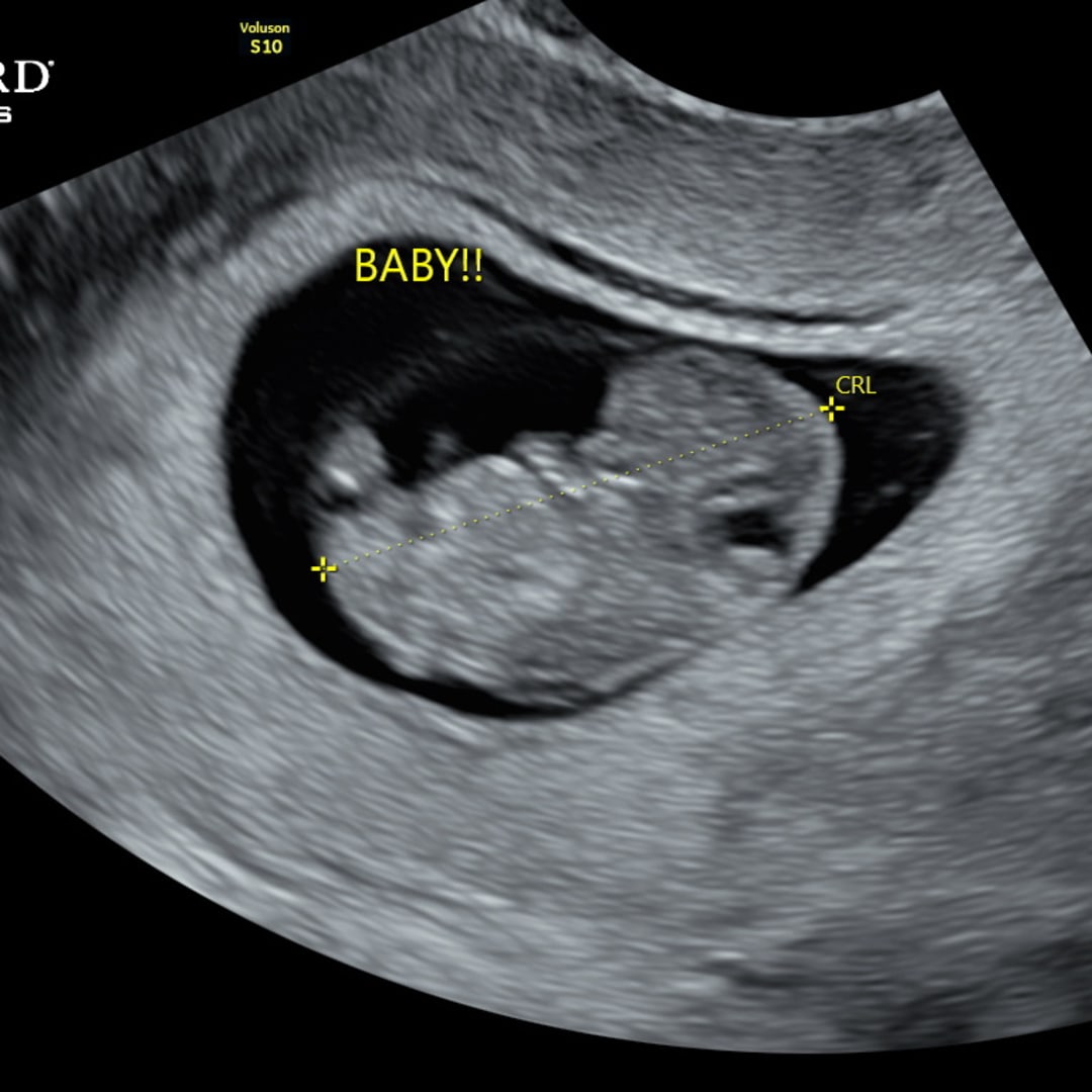Photo shared by Brittany for their Babylist baby registry.
