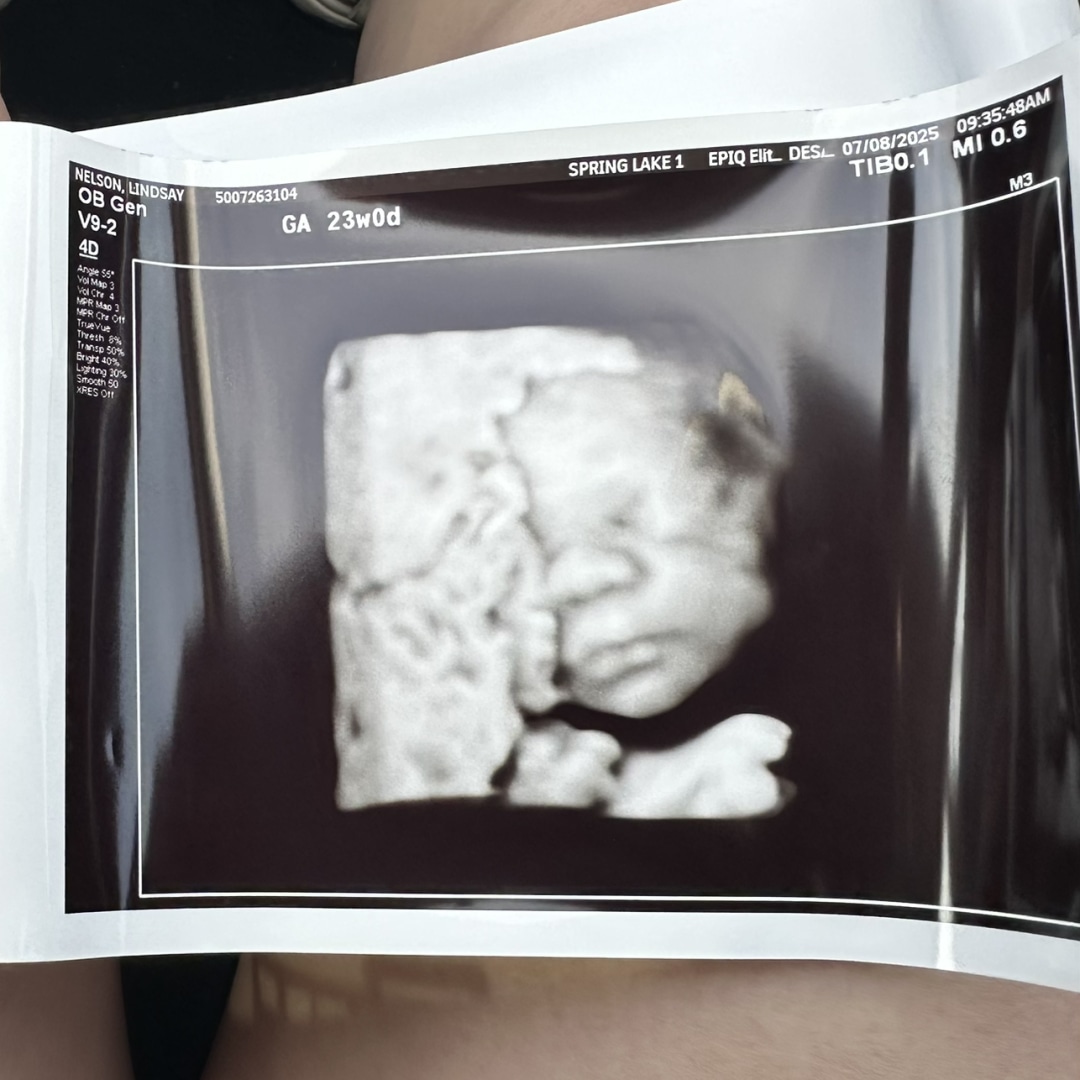 Photo shared by Lindsay for their Babylist baby registry.