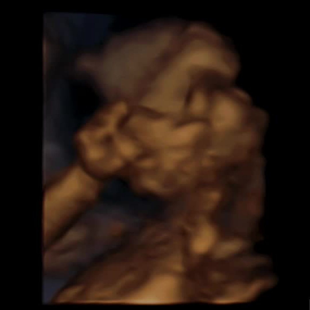 Photo shared by Jacqueline for their Babylist baby registry.