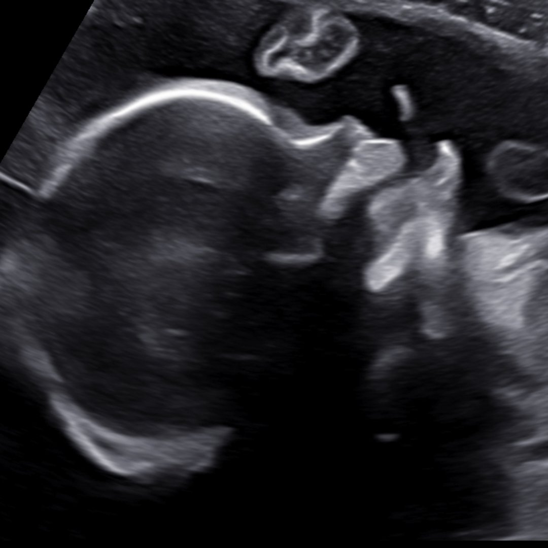 Photo shared by Manzanita for their Babylist baby registry.