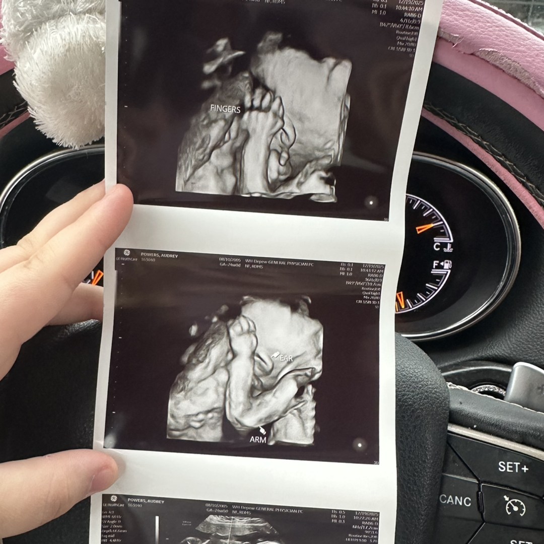 Photo shared by Audrey for their Babylist baby registry.