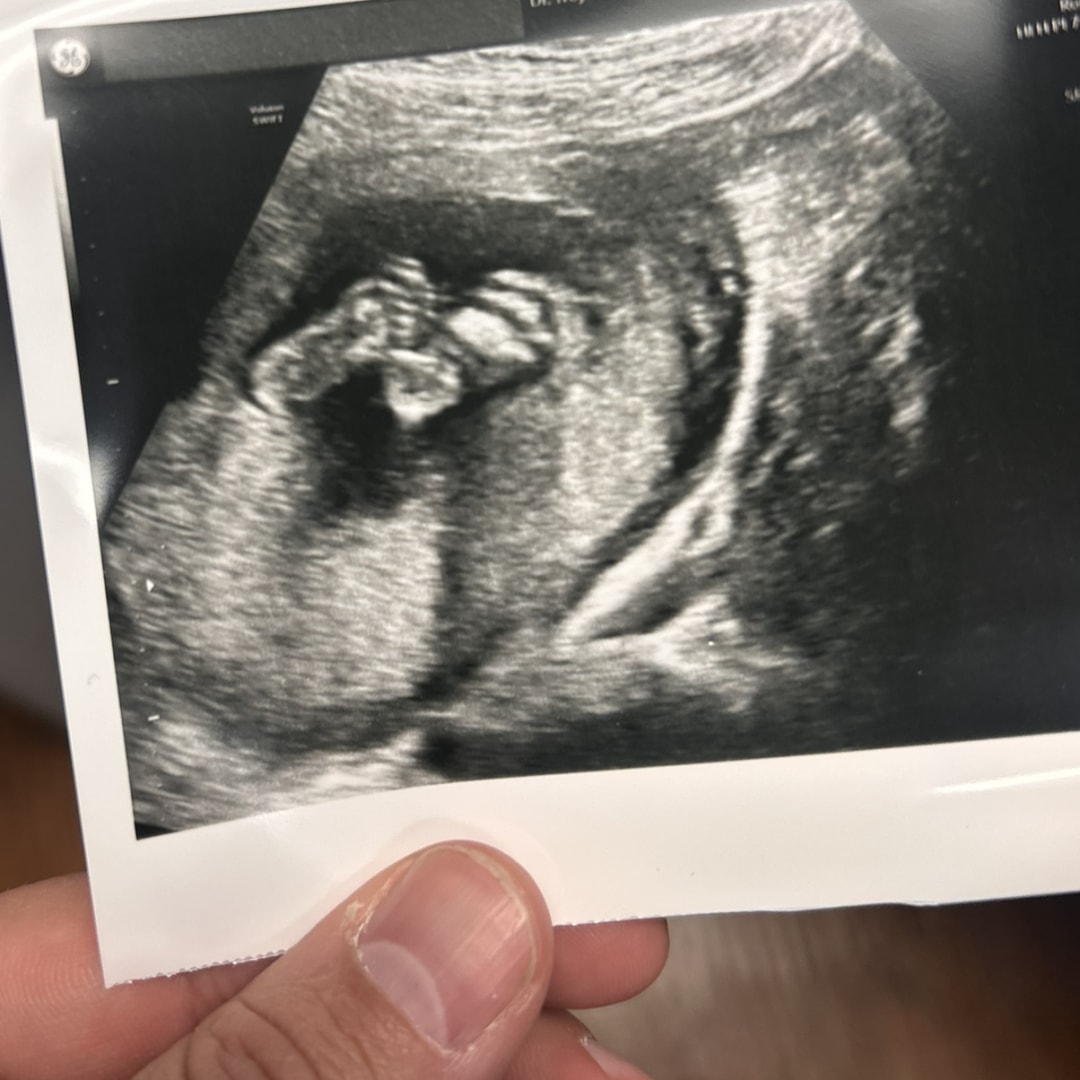 Photo shared by Jacquelyn for their Babylist baby registry.